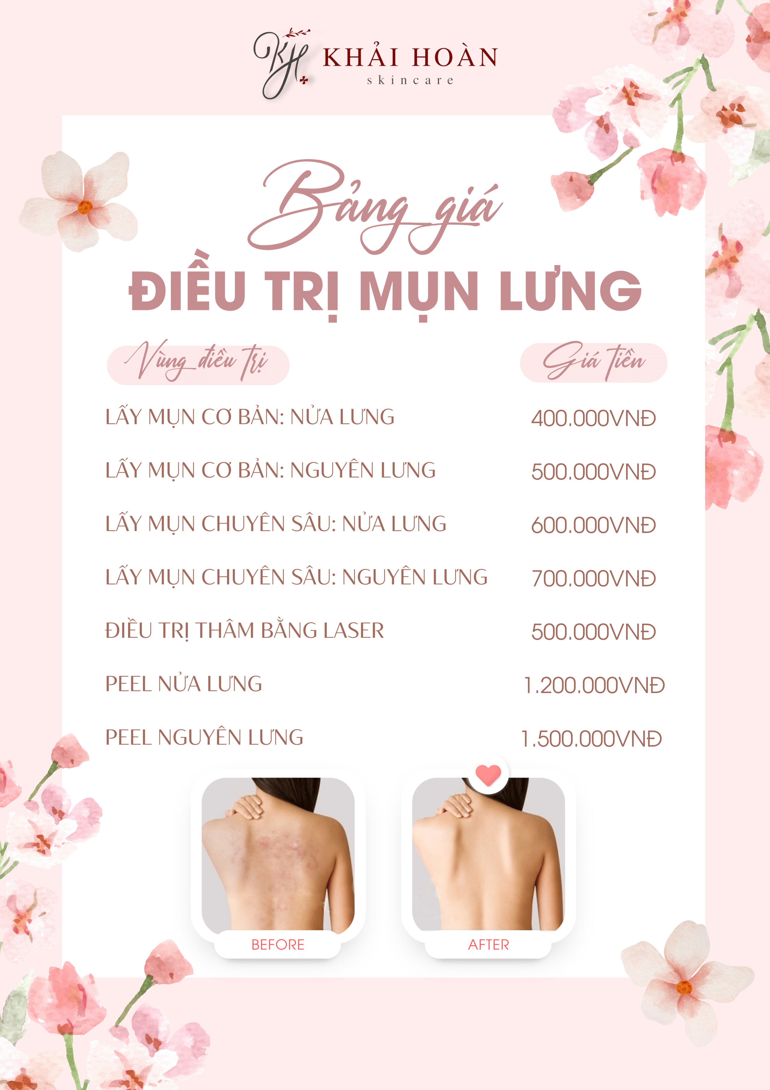 khaihoanskincare - bang gia tri mun lung