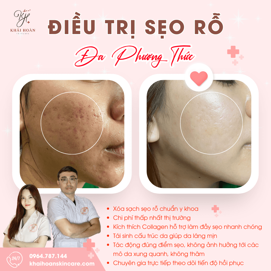 pp seo ro 6
