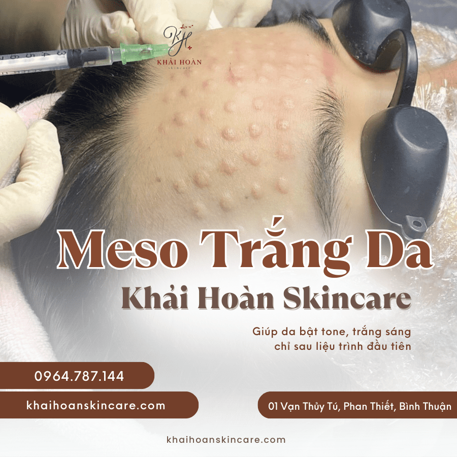 5 Điều Bạn Cần Biết Từ Chuyên Gia Khi Lựa Chọn Tiêm Meso 8 5 dieu meso 2