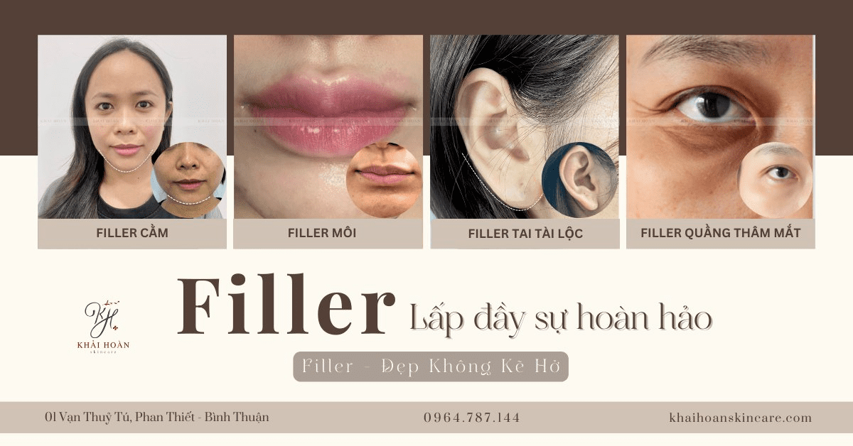 filler meso 3