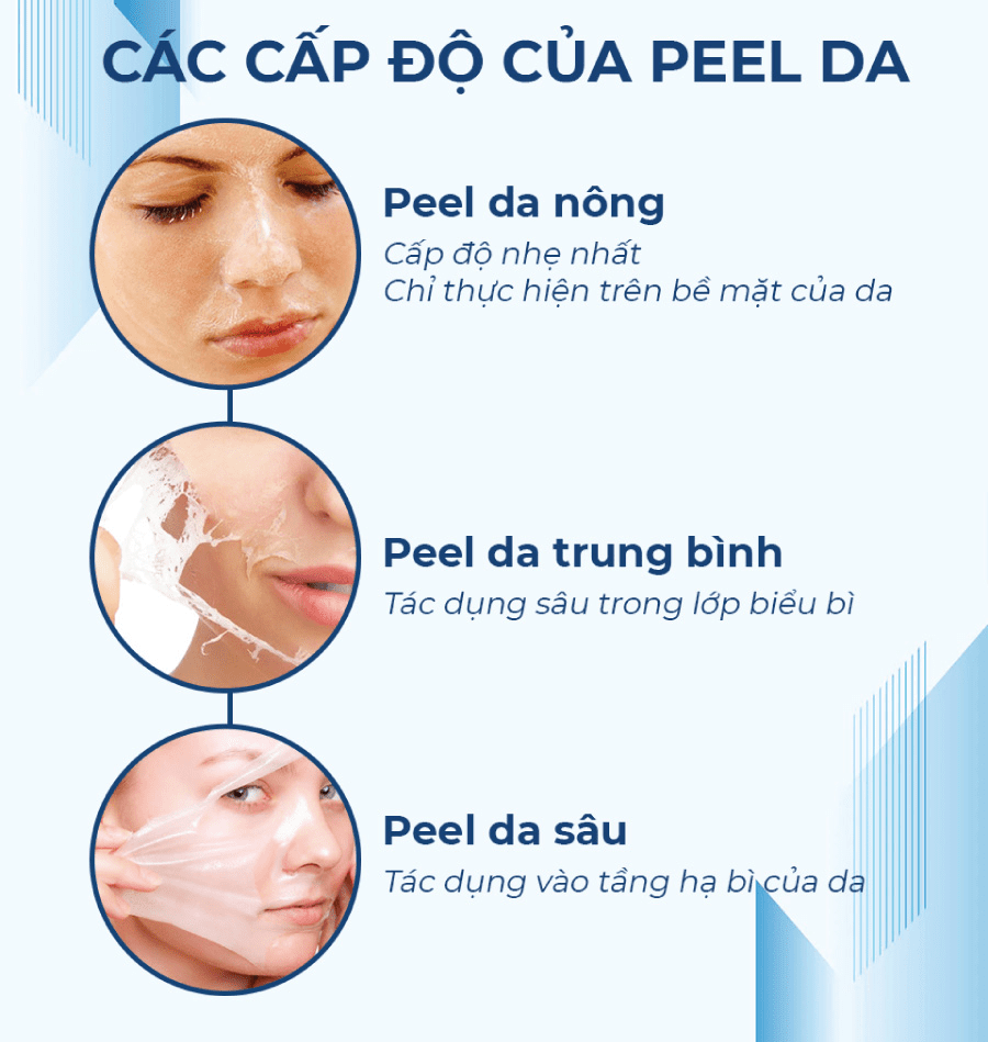 Peel Da Hóa Học Là Gì? Càng Bóc Tróc Nhiều Là Càng Hiệu Quả? 6 peel da hoa hoc 1