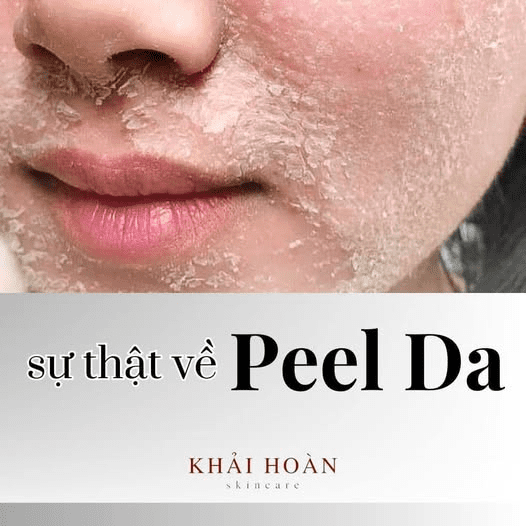 peel da