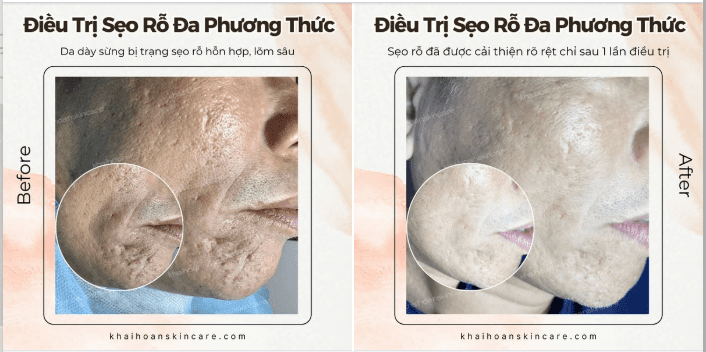1 lieu trinh seo ro 2