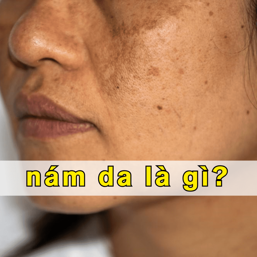 nam da la gi