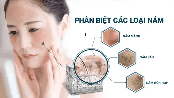 nam da la gi 1