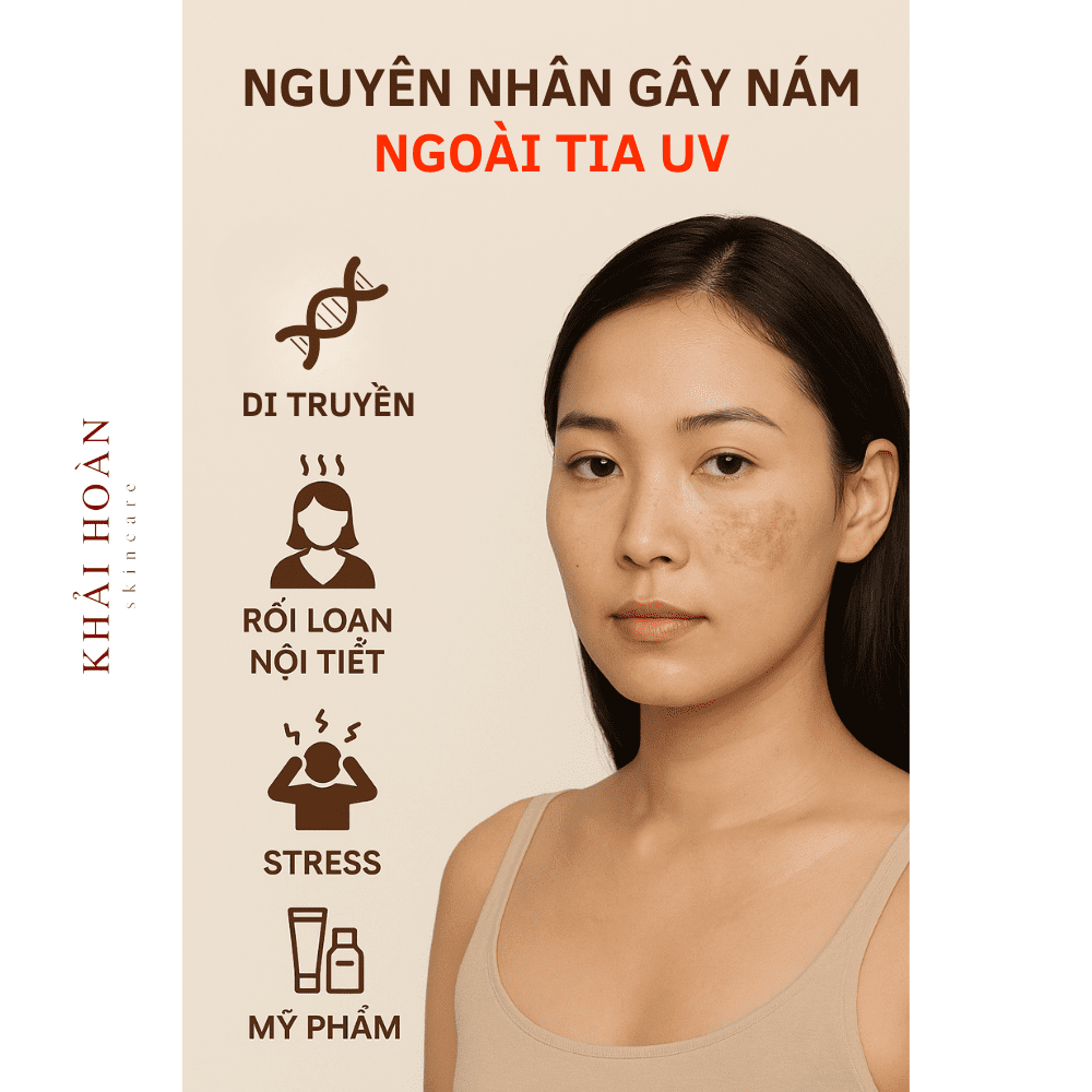 nguyen nhan hinh thanh nam da